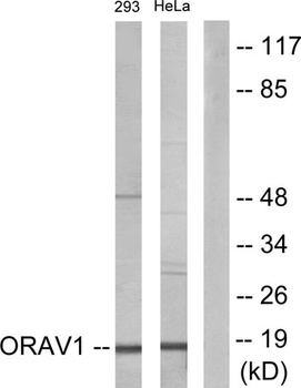 ORAOV1 rabbit pAb Antibody