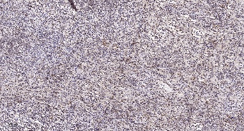 ORAOV1 rabbit pAb Antibody