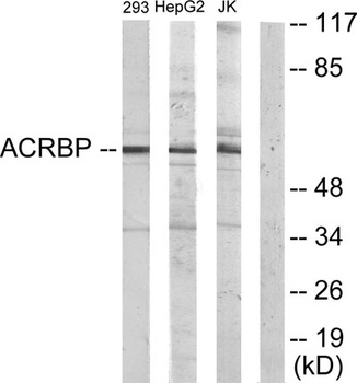 OY-TES-1 antibody