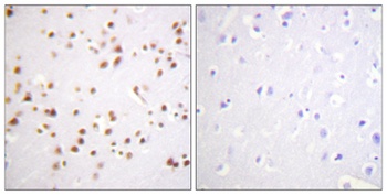 p120 antibody