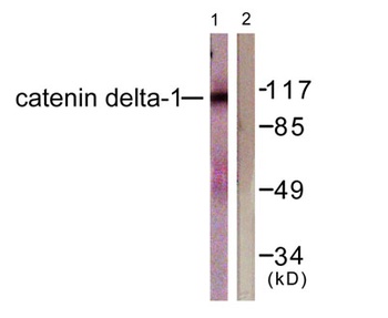 p120 antibody