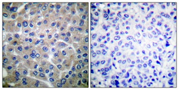 p130 Cas antibody