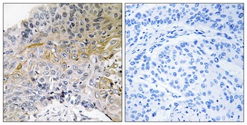 p130 Cas antibody