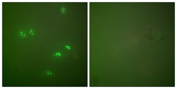 p14 rabbit pAb Antibody