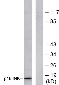 p16 rabbit pAb Antibody