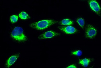 p21 rabbit pAb Antibody