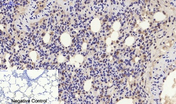 p21 rabbit pAb Antibody