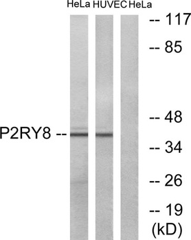 P2RY8 rabbit pAb