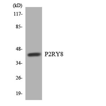 P2RY8 rabbit pAb