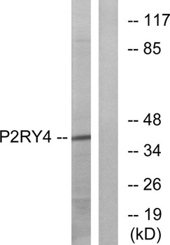 P2Y4 rabbit pAb
