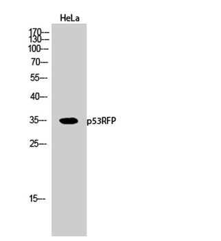p53RFP rabbit pAb
