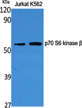 p70 S6 kinase β rabbit pAb