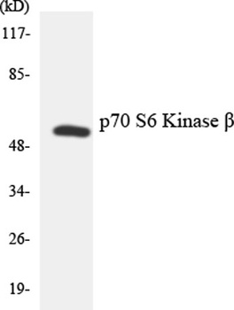 p70 S6 kinase β rabbit pAb