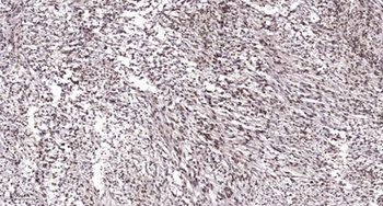 PAF65alpha antibody