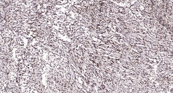 PAF65α rabbit pAb