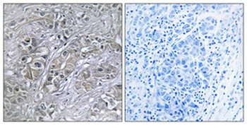 PAI-3 antibody