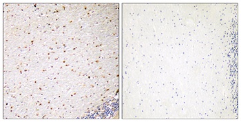 PAK5 antibody