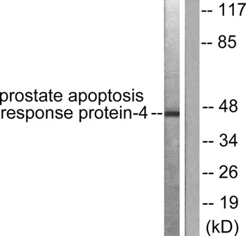 MET antibody