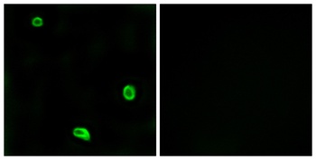 WT1 antibody