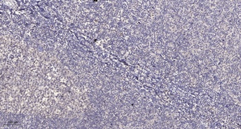 PARD3A antibody