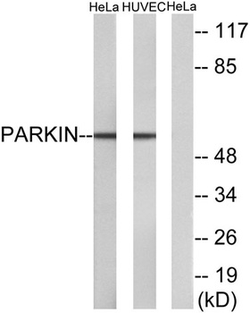 Parkin rabbit pAb