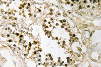 Pax-2 rabbit pAb