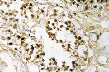 Pax-2 antibody