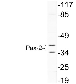 Pax-2 rabbit pAb