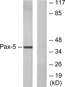 Pax-5 rabbit pAb