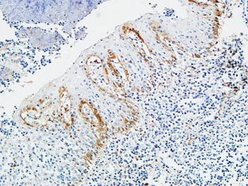 Pax-8 antibody