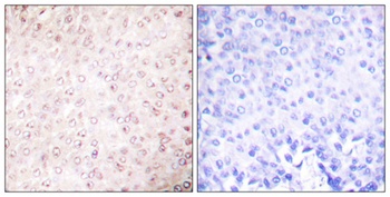 PCAF antibody