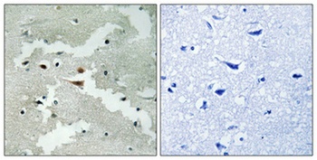 Pdcd-4 antibody