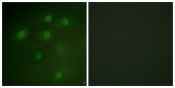 Pdcd-4 rabbit pAb