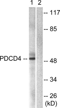 Pdcd-4 rabbit pAb