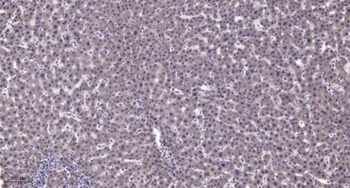 PDE4C antibody