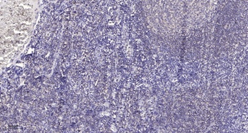 PDHA1 rabbit pAb