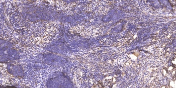 PDK1 rabbit pAb