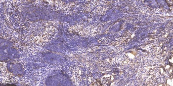 PDK1 antibody