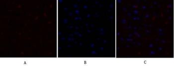 PDK1 antibody