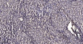 PDK2 rabbit pAb