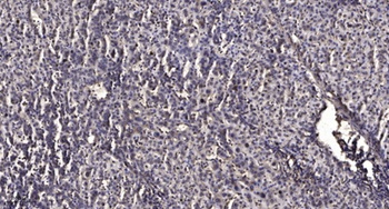 PDK2 antibody