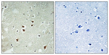 PDRG1 antibody