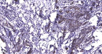 PDXDC1 antibody