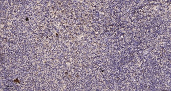 PDZ-RhoGEF rabbit pAb