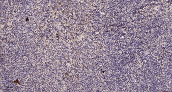 PDZ-RhoGEF antibody