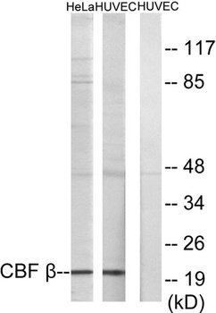PEBP2β rabbit pAb