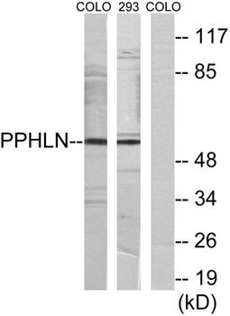 Periphilin 1 rabbit pAb