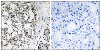 Peroxin 14 rabbit pAb