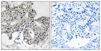 Peroxin 2 rabbit pAb