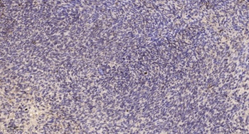 Peroxin 3 rabbit pAb